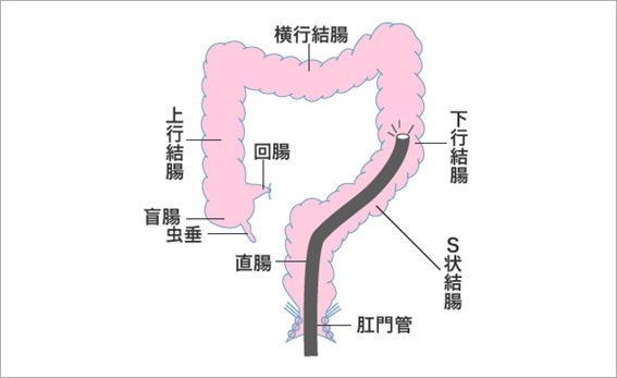 大腸内視鏡検査（大腸カメラ）